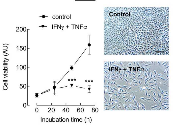At the indicated times, cell viability was determined with the resazurin assay.jpg